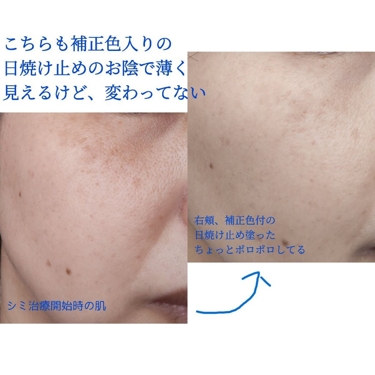 シナール錠200(医薬品)/シオノギ製薬/その他を使ったクチコミ(3枚目)