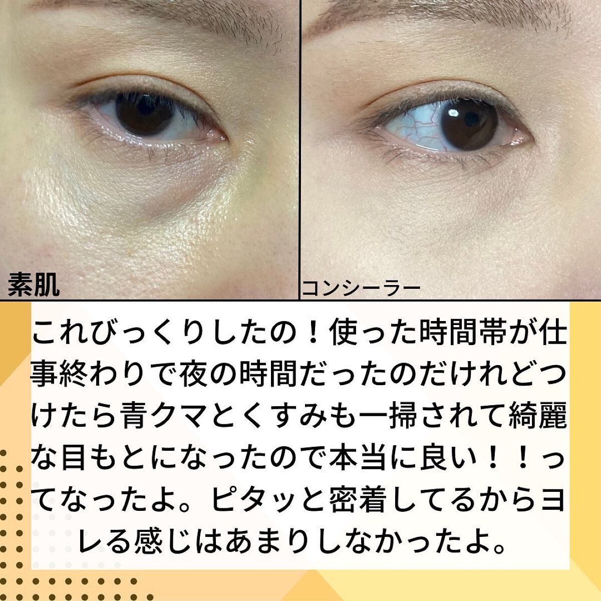 リシェ レッドトリック アイコンシーラー/Visée/パレットコンシーラーを使ったクチコミ（3枚目）