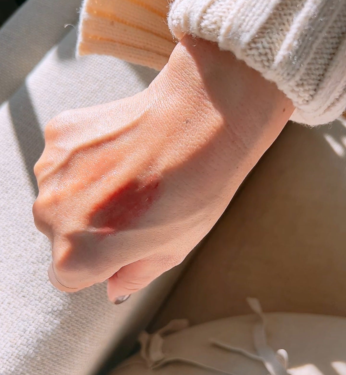 サンキスド プランプ リップバーム/shaishaishai/リップバームを使ったクチコミ(7枚目)