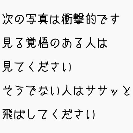 BCローション/ANCLVIS/化粧水を使ったクチコミ(4枚目)