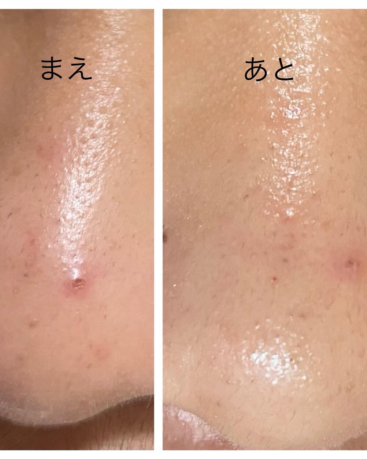 BHクリアノーズパック/CucuporeC/シートマスク・パックを使ったクチコミ(2枚目)