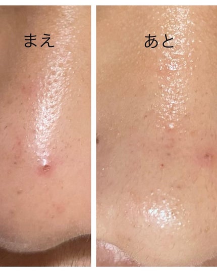 BHクリアノーズパック/CucuporeC/シートマスク・パックを使ったクチコミ(2枚目)