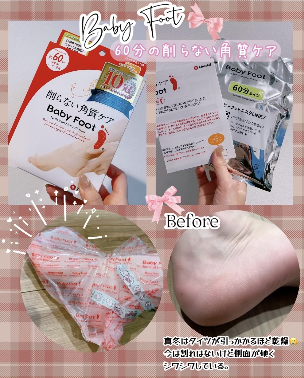 イージーパックDP60分タイプ/ベビーフット/レッグ・フットケアを使ったクチコミ（1枚目）