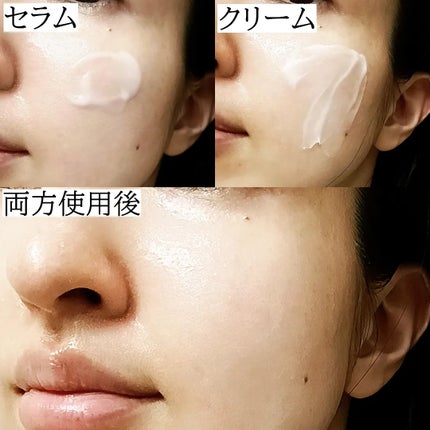 バクチオールポアジェットセラム/Dr.G/美容液を使ったクチコミ(4枚目)