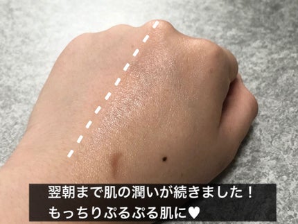 デュイセル シカプラスバーム/DEWYCEL/フェイスクリームを使ったクチコミ(4枚目)