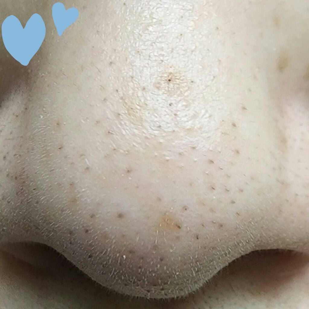 ソフィーナ iP ポア クリアリング ジェル ウォッシュ/SOFINA iP/その他洗顔料を使ったクチコミ(8枚目)