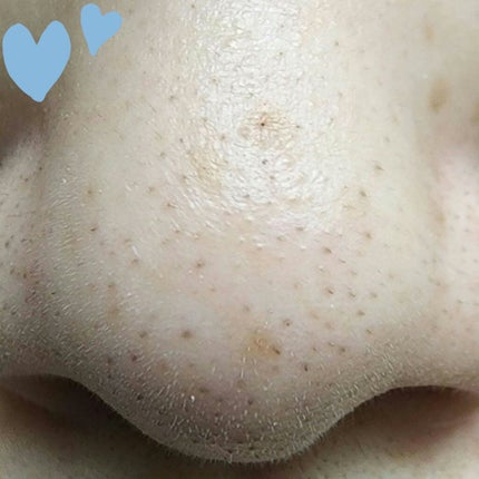 ソフィーナ iP ポア クリアリング ジェル ウォッシュ/SOFINA iP/その他洗顔料を使ったクチコミ(8枚目)