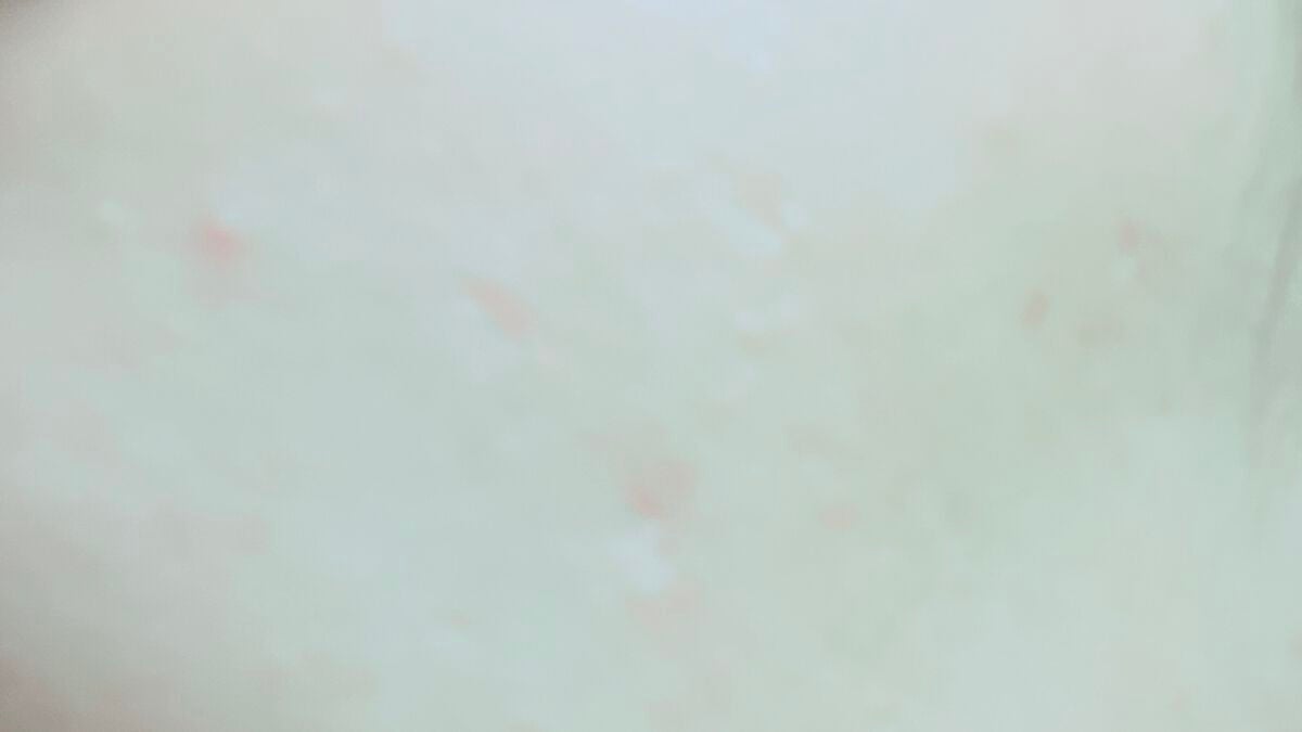 ステムトリートメント ローションセラム/Reinca/化粧水を使ったクチコミ(3枚目)