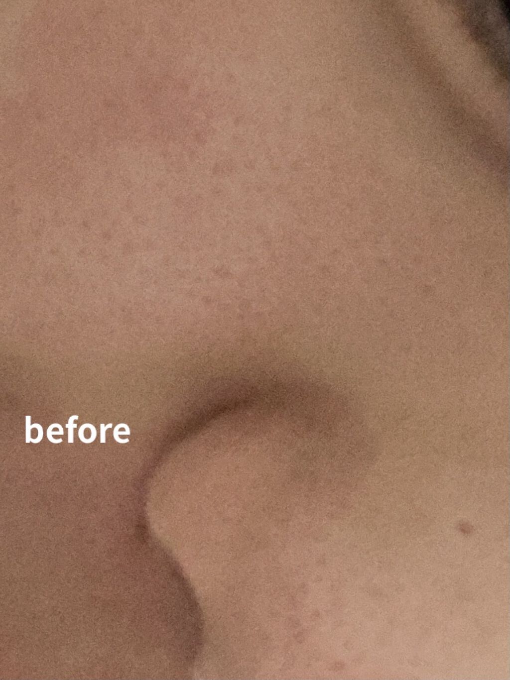 ノーモアブラックヘッド(ノーズピーリング)/One-day's you/スクラブ・ゴマージュを使ったクチコミ（2枚目）