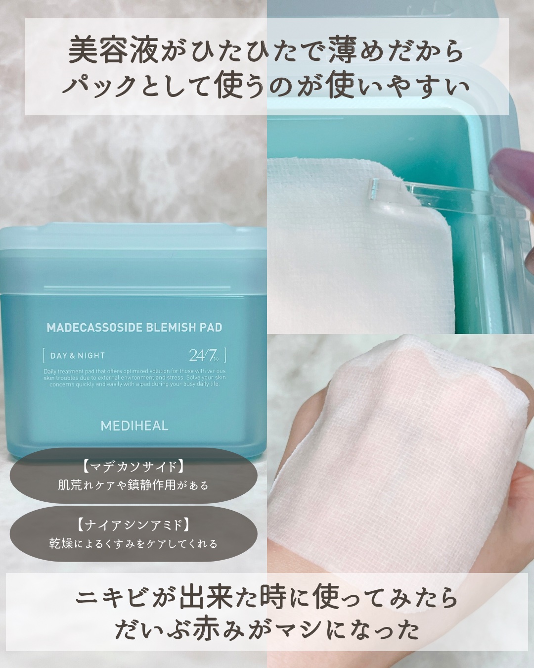 マデカソサイド ブレミッシュパッド/MEDIHEAL/トナーパッドを使ったクチコミ（3枚目）