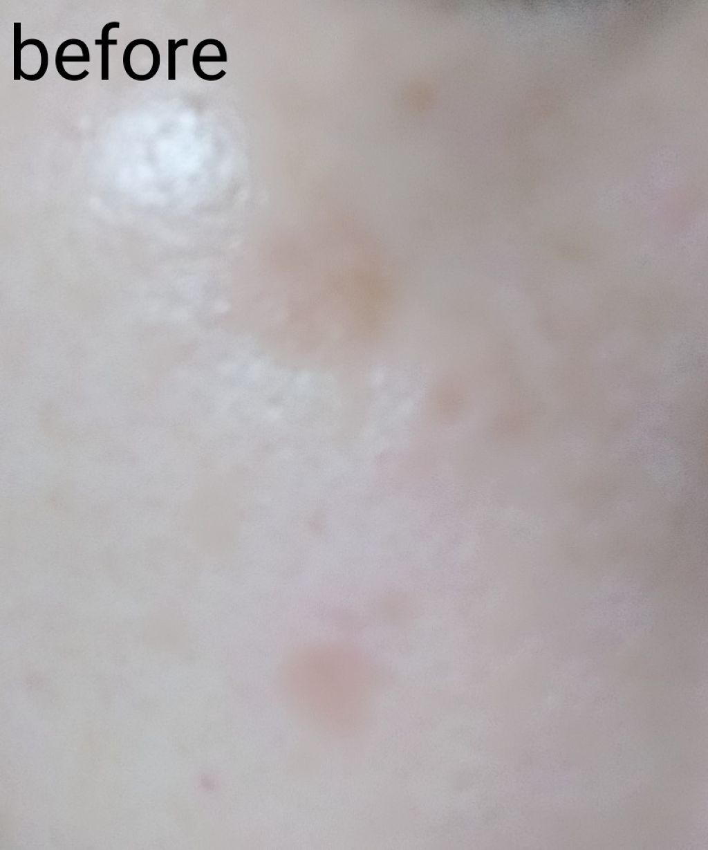 グリーンタンジェリン ビタC ダークスポットケアセラム/goodal/美容液を使ったクチコミ（2枚目）