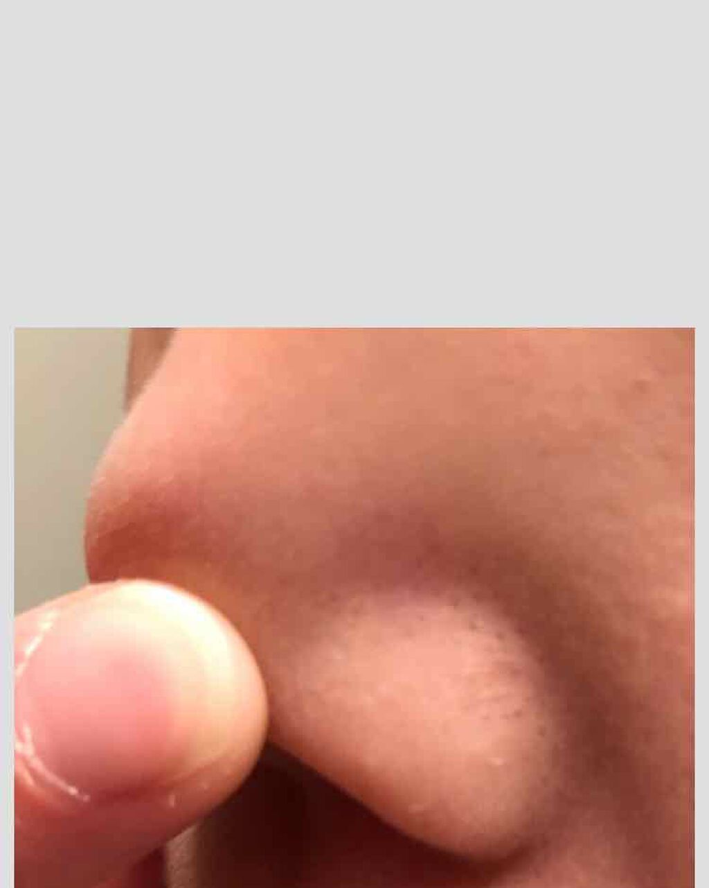 シラクル ビューティシート/Ciracle/トナーパッドを使ったクチコミ(2枚目)