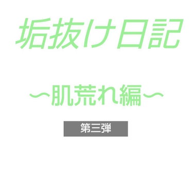 こんにちは！まゆおです！！
ついに肌荒れ編第三弾ということで、
前回は肌荒れが良くなったと思う商品を紹介しましたが、
今回は逆に肌荒れが酷くなった商品をご紹介します。

…………………………………………