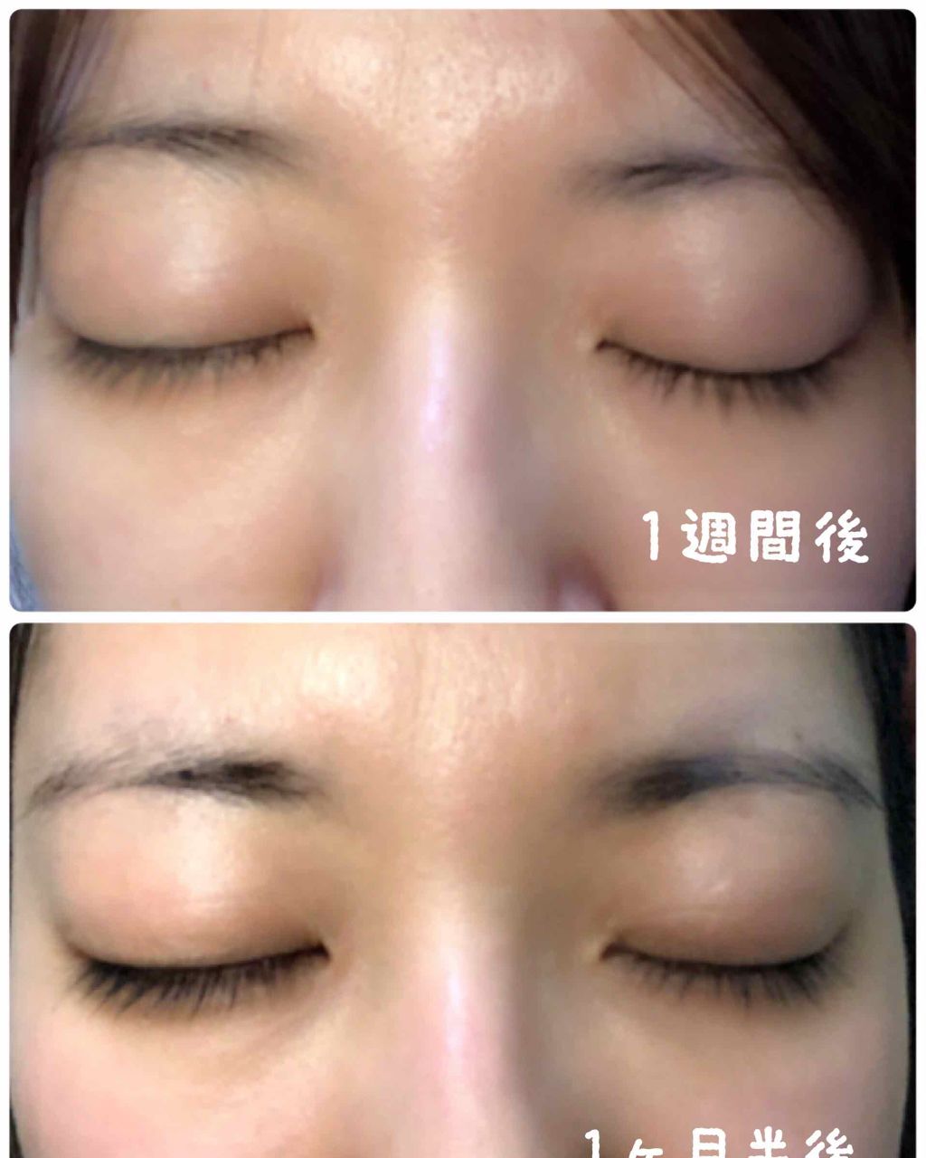 D濃密美容液 ローヤルゼリー/DAISO/美容液を使ったクチコミ(4枚目)