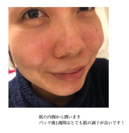 ハイドロゲルスリーピングパック/Dermal/シートマスク・パックを使ったクチコミ(5枚目)