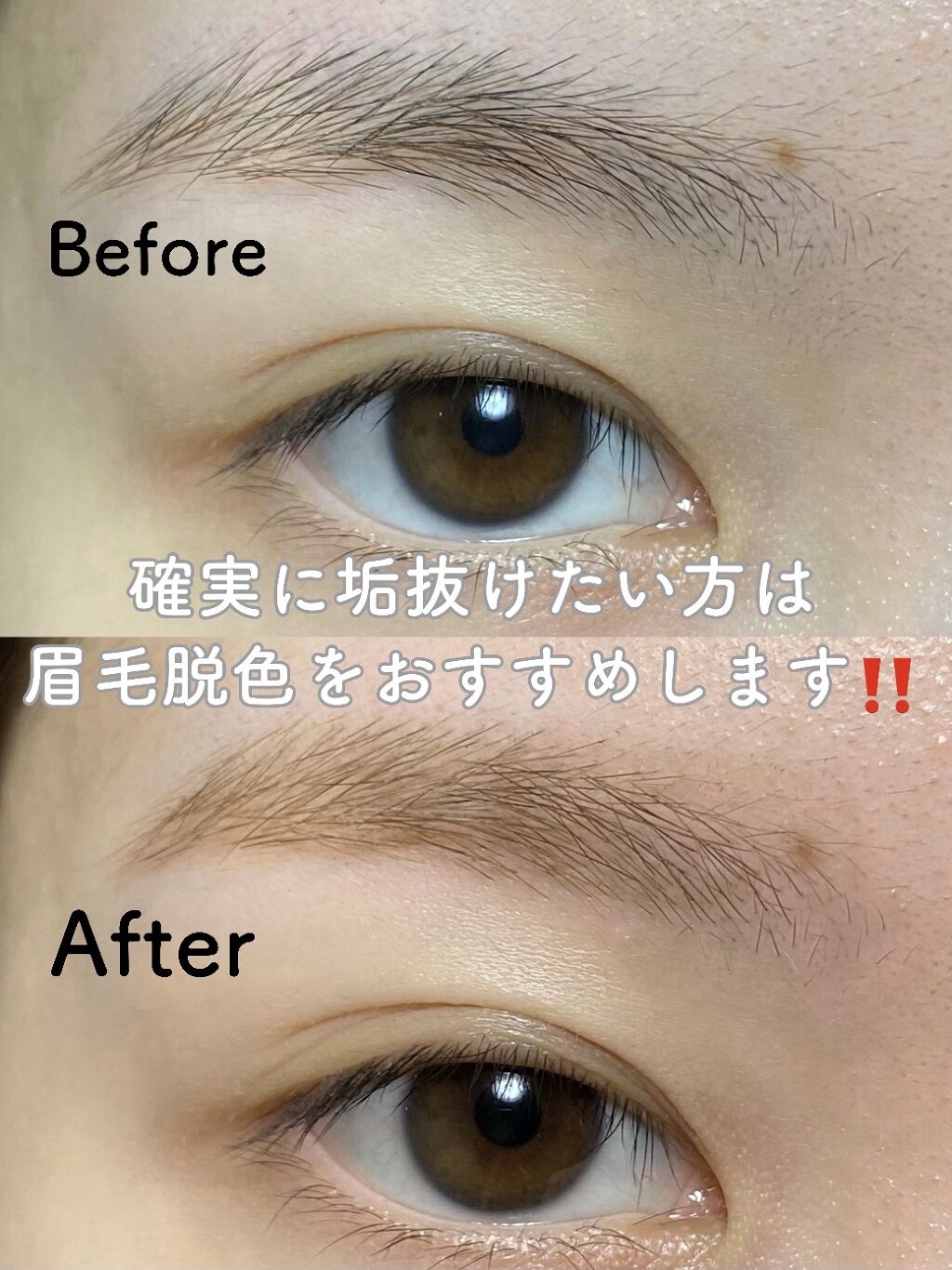 脱色クリーム スピーディー/エピラット/ムダ毛ケアを使ったクチコミ（1枚目）