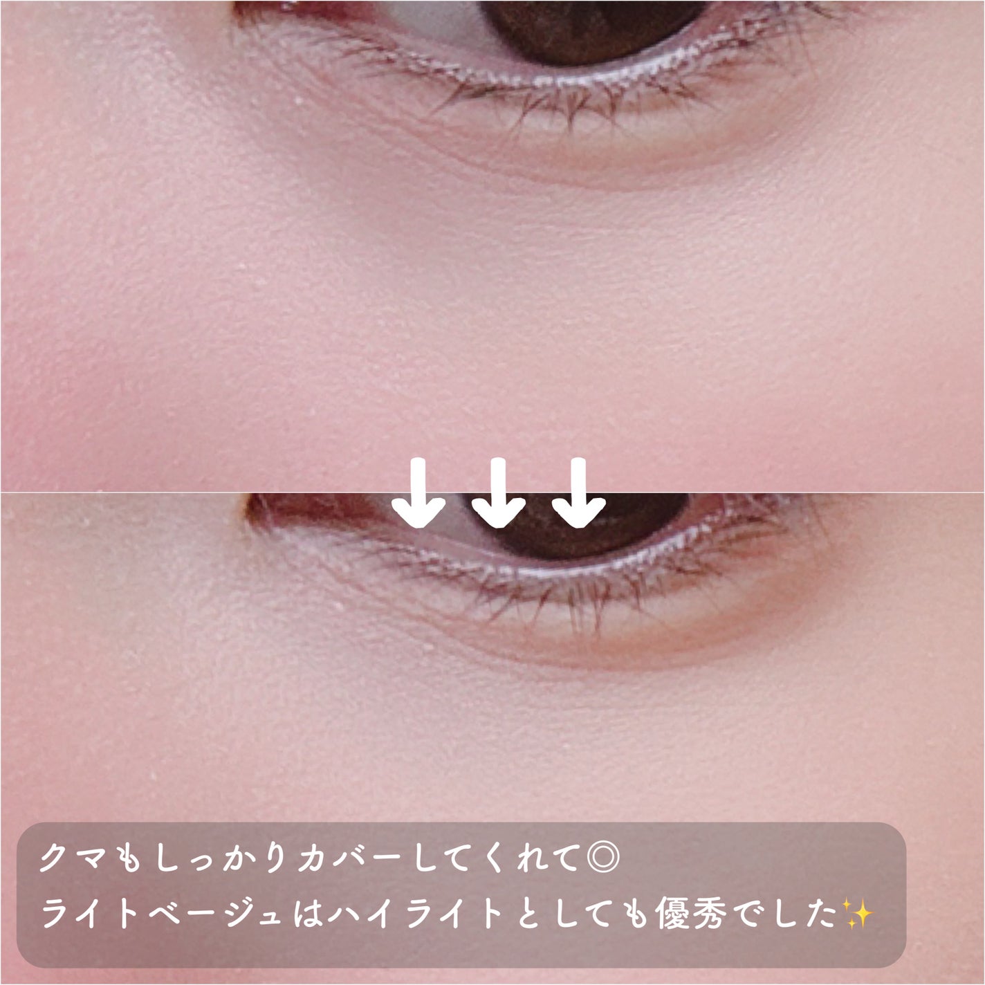 カバーアッププロコンシーラー/TFIT/パレットコンシーラーを使ったクチコミ(5枚目)