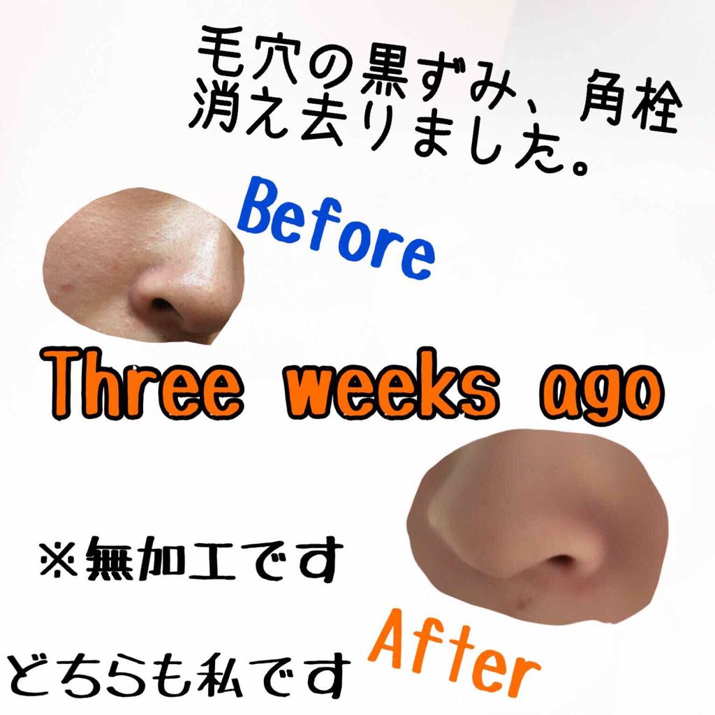 敏感肌用薬用美白美容液/無印良品/美容液を使ったクチコミ(1枚目)