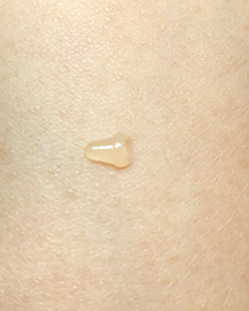 DAISO ネイルトリートメントジェルDのクチコミ「
ダイソー
ネイルトリートメントジェル



コロナの影響もあり、
外出先でも手洗いが増えて、.....」（3枚目）