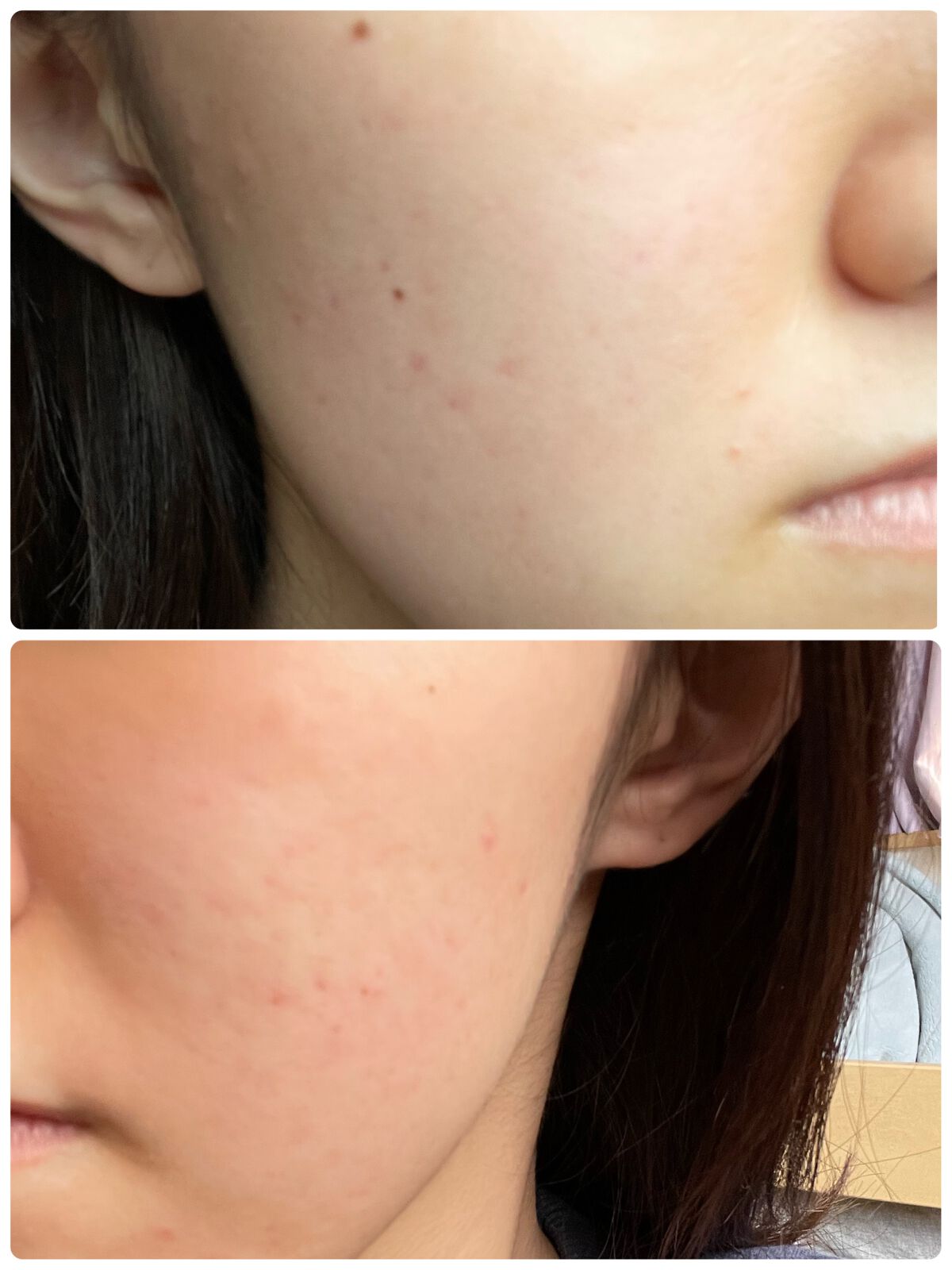 白潤プレミアム薬用浸透美白化粧水/肌ラボ/化粧水を使ったクチコミ(2枚目)