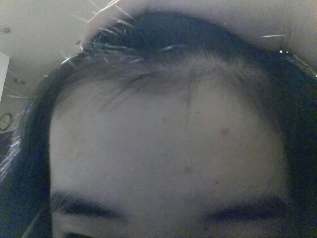 まお on LIPS 「私のこの肌荒れを治せるような洗顔を知っている人がいたら教えて下..」(1枚目)