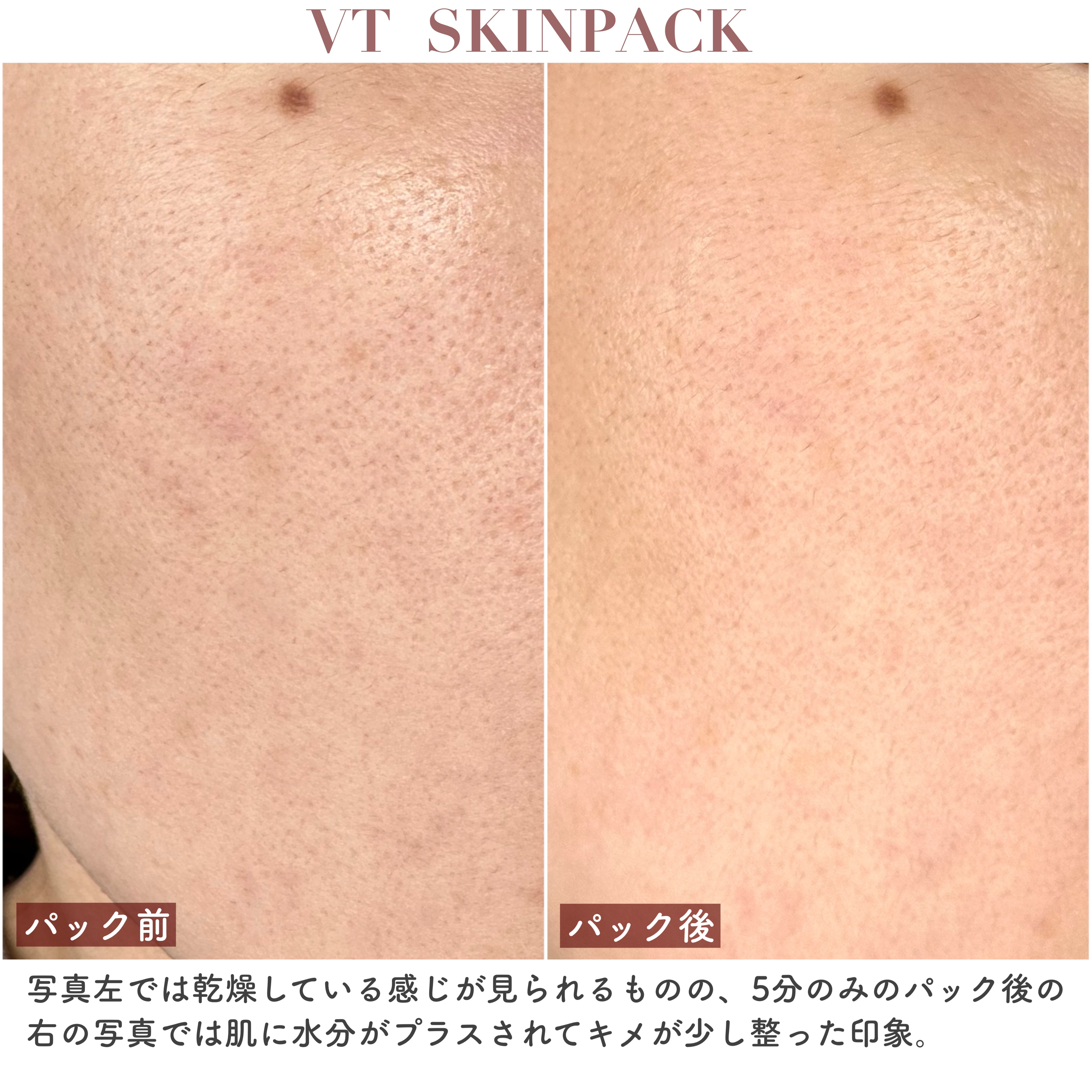 マイルドスキンパック/VT/シートマスク・パックを使ったクチコミ（3枚目）