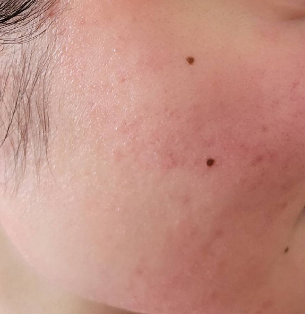 ごめんね素肌マスク/クリアターン/シートマスク・パックを使ったクチコミ（3枚目）