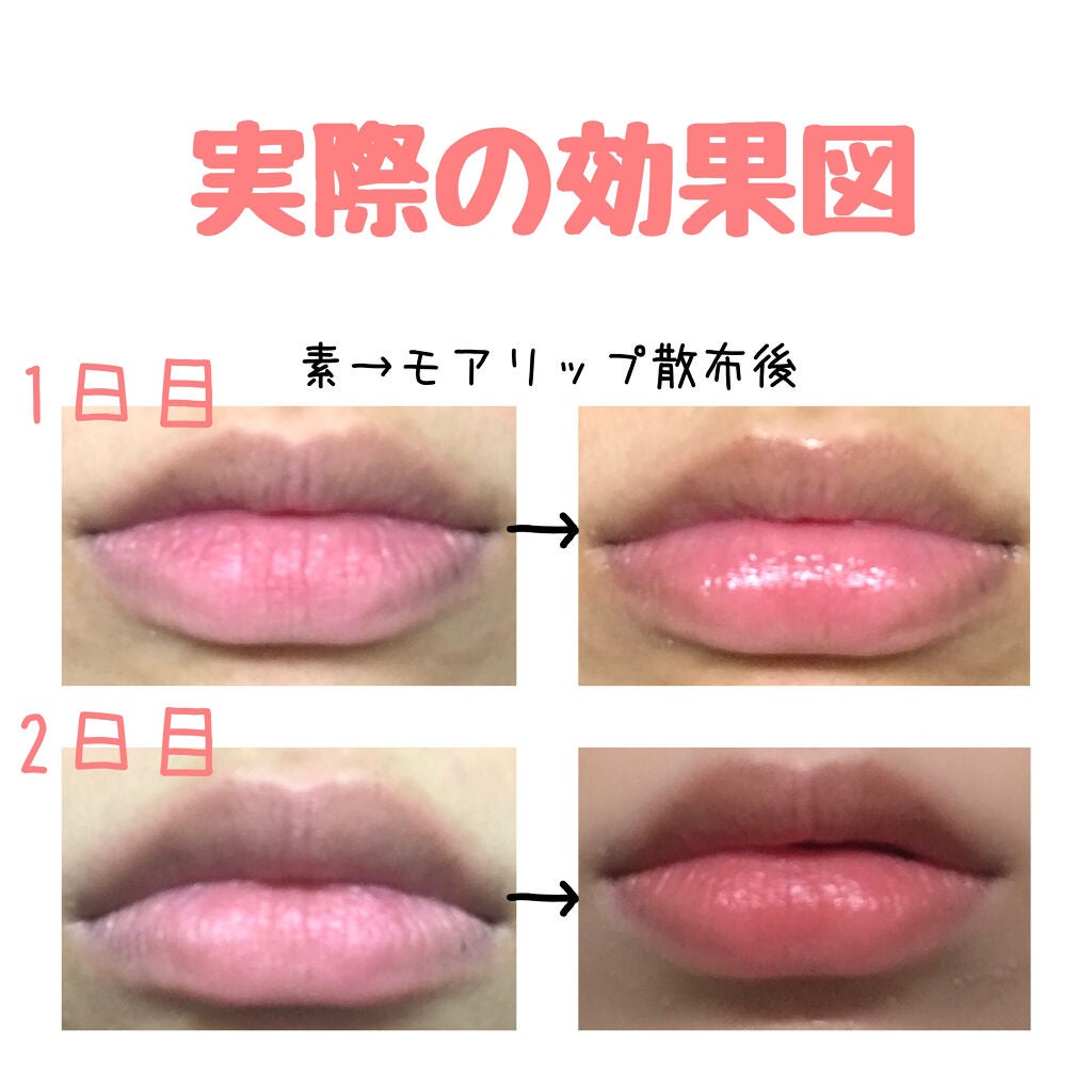 モアリップ N (医薬品)/資生堂薬品/その他を使ったクチコミ(3枚目)