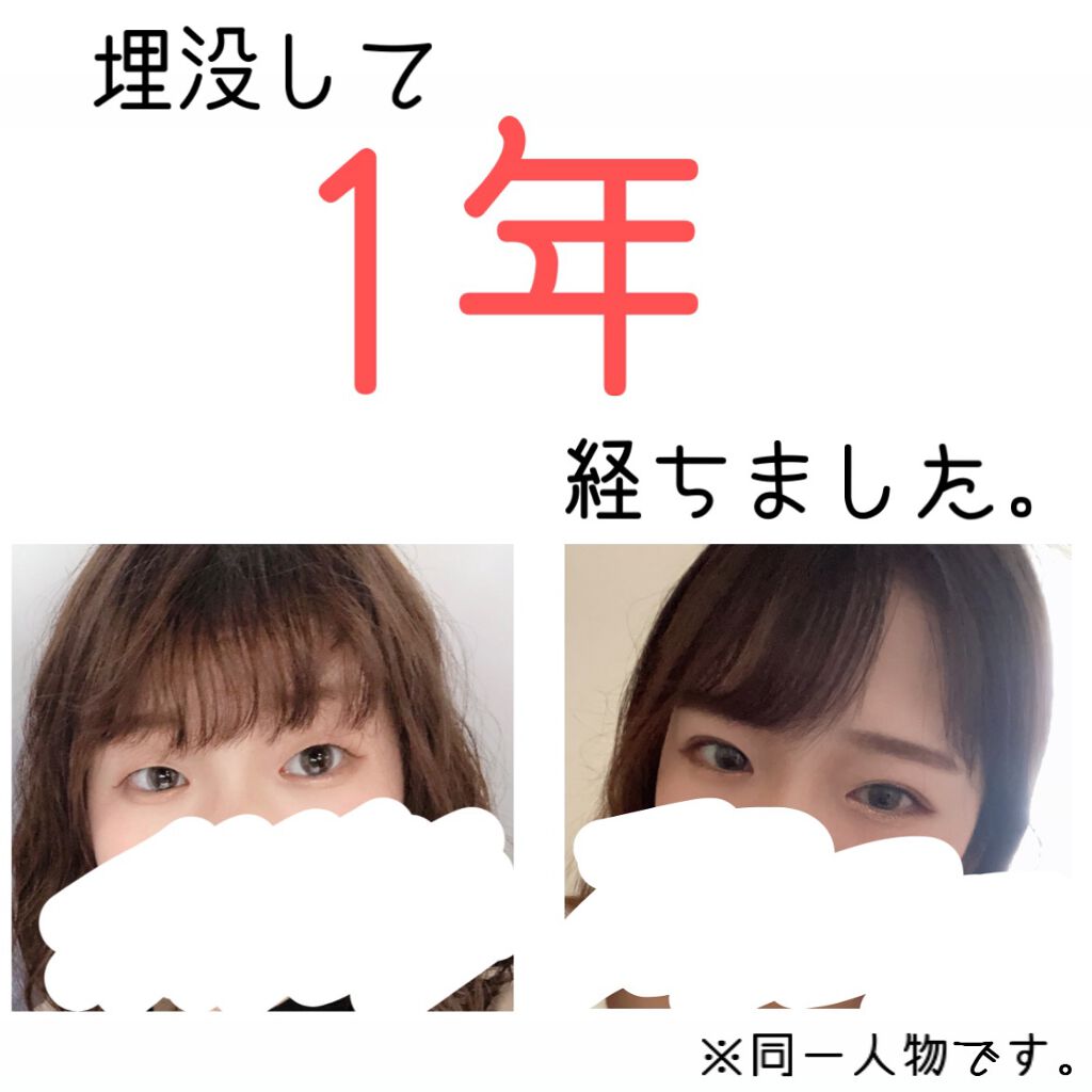 Sakuð· on LIPS ãæ°ã¥ãããâŠå没ããŠâŠ1幎ãçµã¡ãŸãããç¹ã«ä»ã®ãšããåé¡ã¯ã..ãïŒ1æç®ïŒ