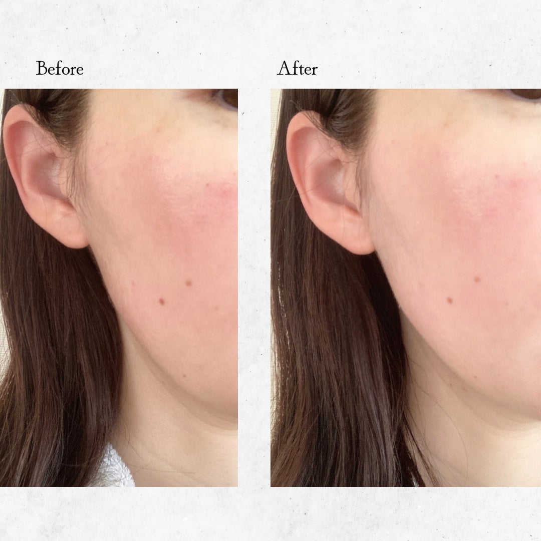 ポアブラーアップサン/Dr.G/日焼け止めクリームを使ったクチコミ(4枚目)