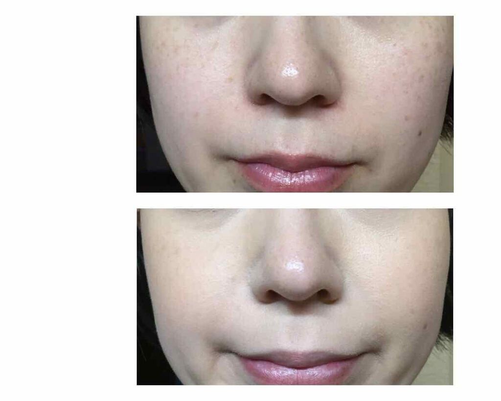 マジックコンシーラー/カリプソ/リキッドコンシーラーを使ったクチコミ(4枚目)