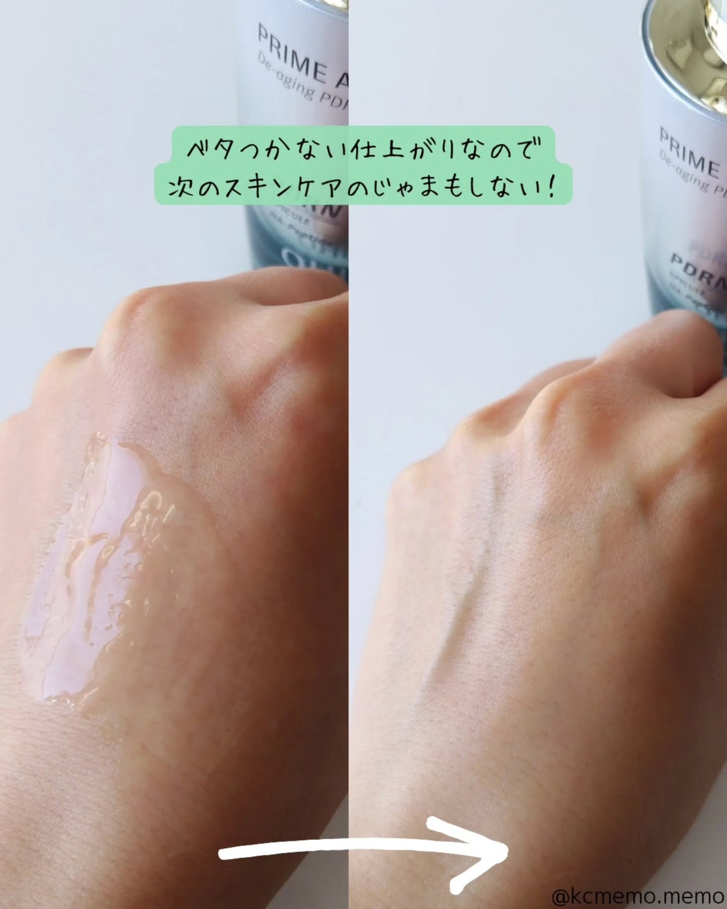 メモ魔ちゃん@韓国コスメメモ日記 on LIPS 「PDRN針コスメ!本日のメモ✍️OHUI♡プライムアドバンスデ..」(4枚目)