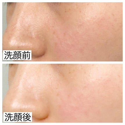 ダヴ 吸着毛穴ケア 洗顔ジェル/ダヴ/その他洗顔料を使ったクチコミ(4枚目)