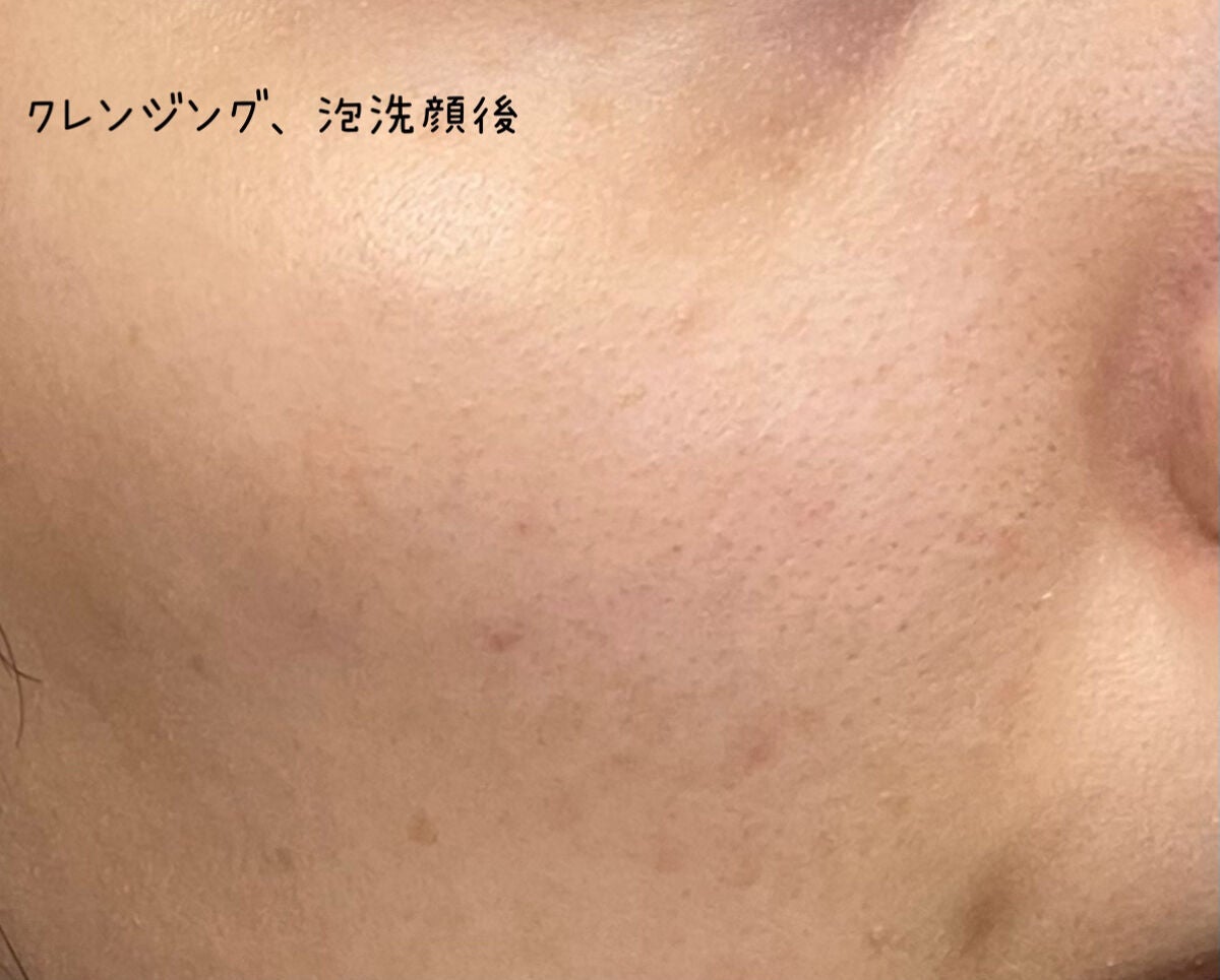 DETクリア ブライト&ピール ピーリングジェリー <ミックスベリーの香り>/Detclear/ピーリングを使ったクチコミ(4枚目)