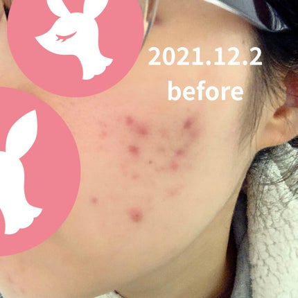 Noni Ampule/celimax/美容液を使ったクチコミ(4枚目)