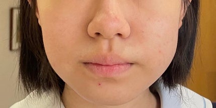 ティーツリーケアソリューション アンプルマスクJEX/MEDIHEAL/シートマスク・パックを使ったクチコミ(3枚目)