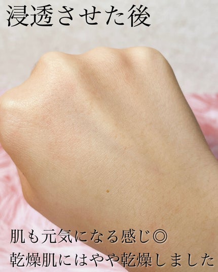 フルフィットプロポリスシナジートナー/COSRX/化粧水を使ったクチコミ(5枚目)