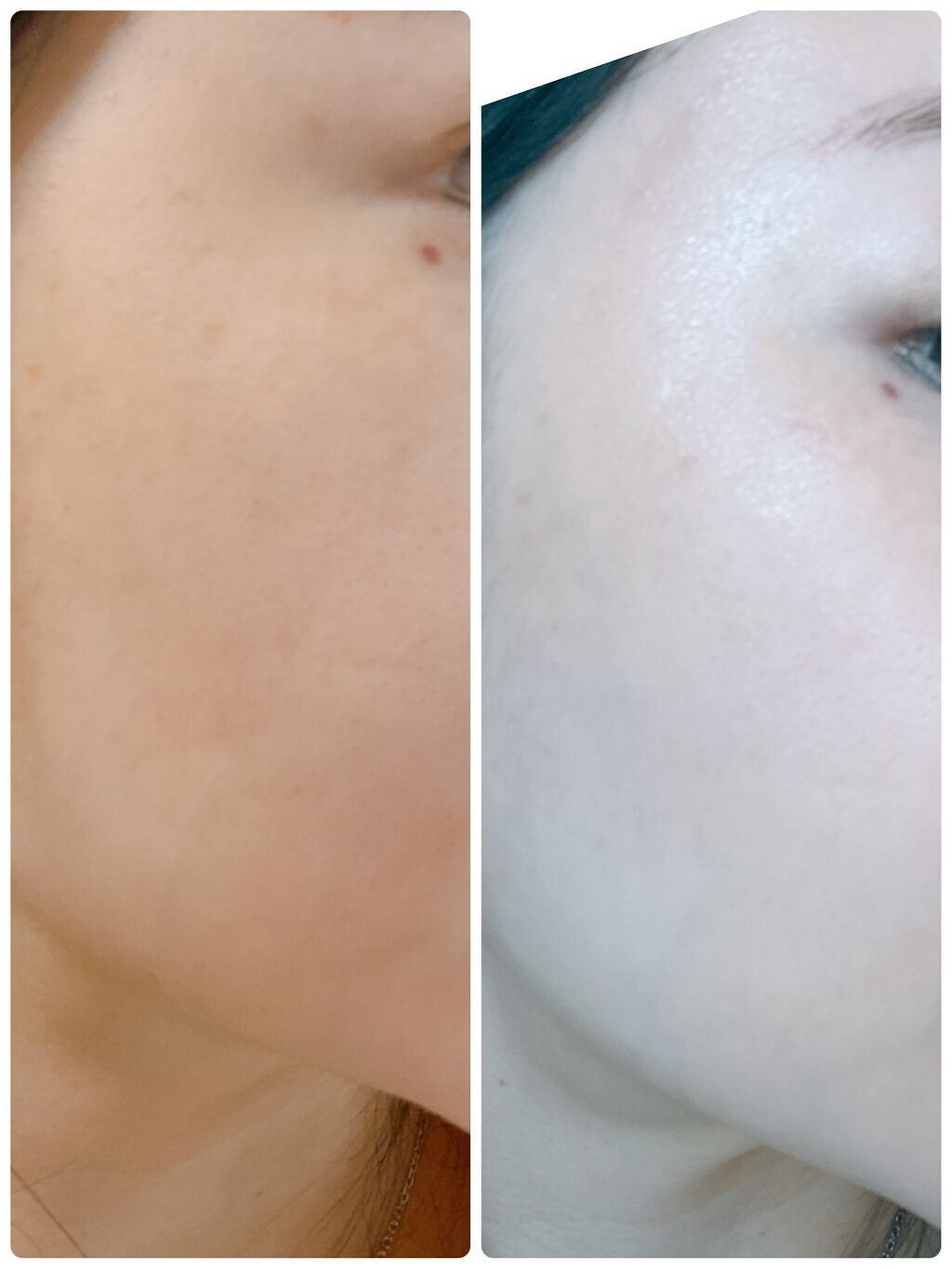 オーガニアンス ウォータリー エッセンス/primera/化粧水を使ったクチコミ（3枚目）