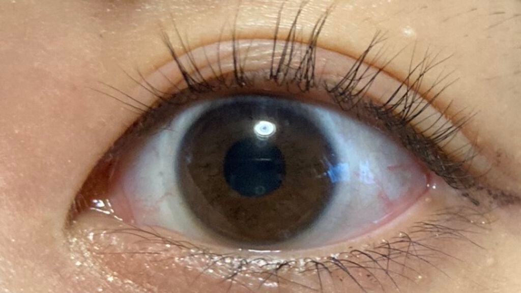 ひとえ・奥ぶたえ用カーラー/アイプチ®/ビューラーを使ったクチコミ(1枚目)