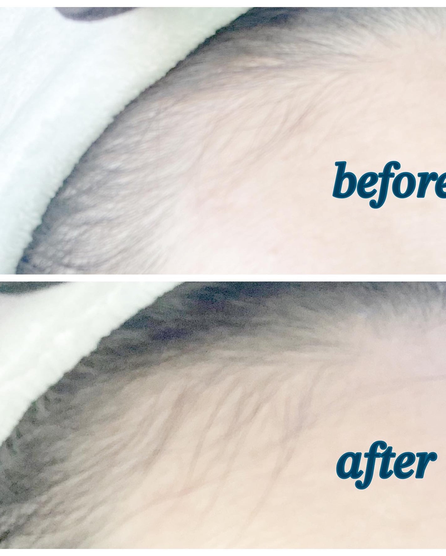 Wアプローチヘアプログラム/MUNOAGE(ミューノアージュ)/頭皮ローションを使ったクチコミ(5枚目)