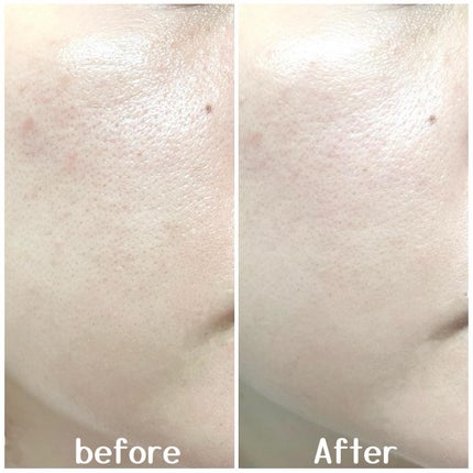 リードルショット100/VT/美容液を使ったクチコミ(5枚目)