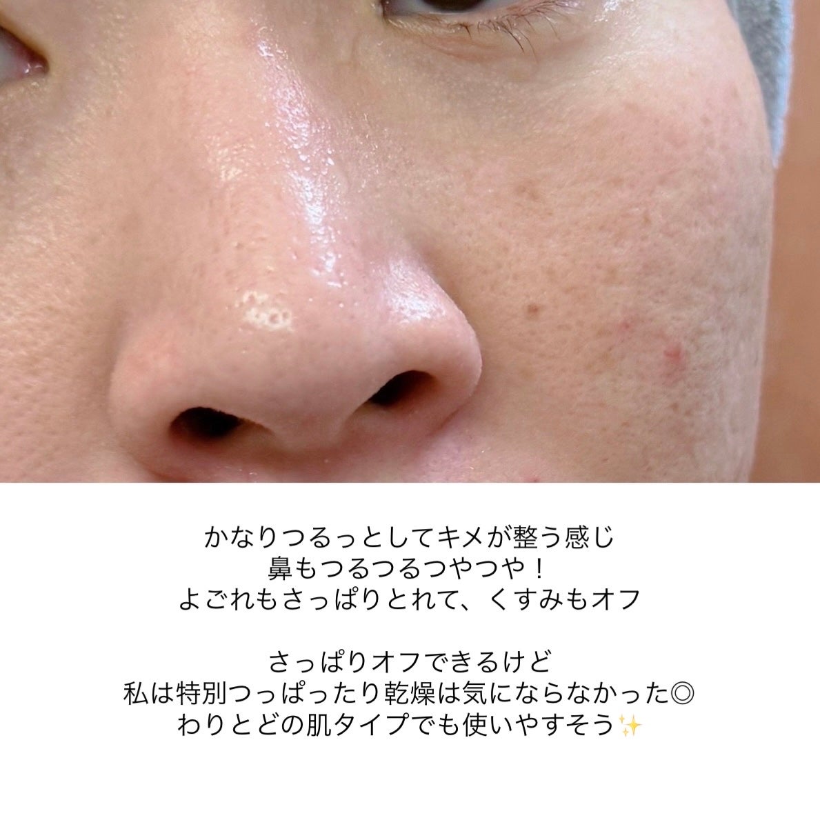 センテラ ライトクレンジングオイル/SKIN1004/オイルクレンジングを使ったクチコミ(8枚目)