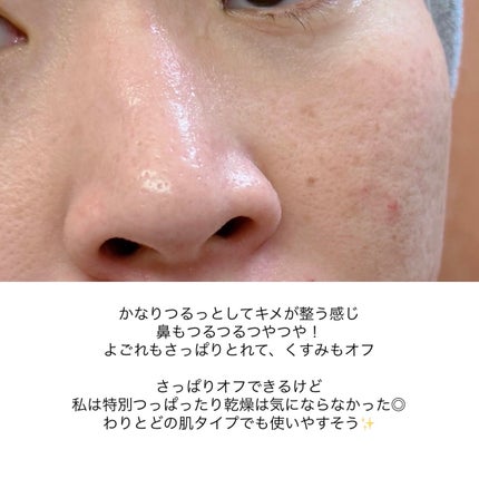 センテラ ライトクレンジングオイル/SKIN1004/オイルクレンジングを使ったクチコミ(8枚目)