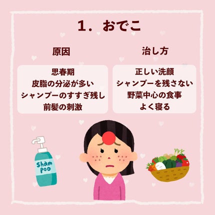 ãã¢ã¢ã¯ãã¯ãªãŒã W(å»è¬å)/ãã¢/ãã®ä»ã䜿ã£ãã¯ãã³ãïŒ2æç®ïŒ