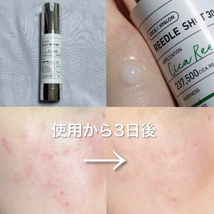 リードルショット300/VT/美容液を使ったクチコミ(2枚目)
