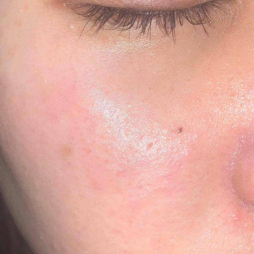 ドクタージャルト シカペア リカバー (第2世代）/Dr.Jart＋/フェイスクリームを使ったクチコミ（2枚目）