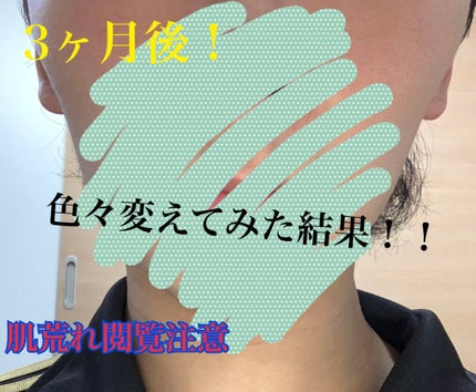 チョコラBBピュア (医薬品)/チョコラBB/その他を使ったクチコミ(1枚目)
