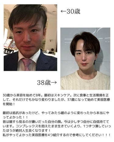 ヒロキ｜奇跡の38歳🌟美容家 on LIPS 「マジで老けたくないのでスキンケア、食事など色々と美容やってきま..」（2枚目）