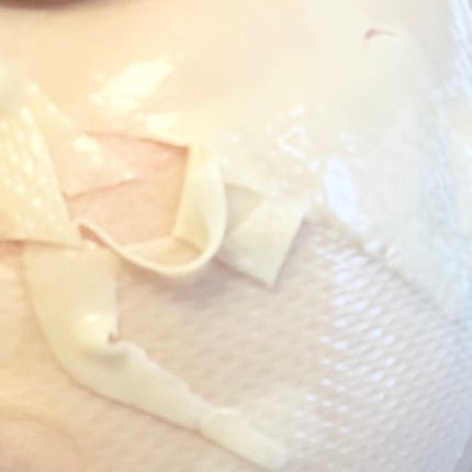 パーフェクト リアル パフォーマンス ビタコラーゲ ンマスクパック /ダーマフィックス/シートマスク・パックを使ったクチコミ(5枚目)