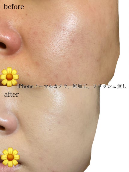 マスクフィットオールカバークッション/TIRTIR(ティルティル)/クッションファンデーションを使ったクチコミ(4枚目)